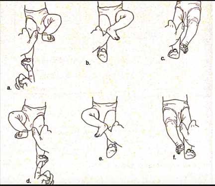 <ul><li><p>primitive reflex - spinal cord</p></li><li><p>develops extensor tone in lower extremities, precursor to creeping and walking</p></li><li><p>stimulate sole of foot with extremity fixed => flexion of opposite lower extremity then extension to push examiner away</p></li></ul><p></p>