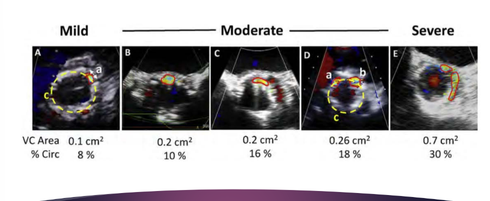<p>Greater than 30%</p>