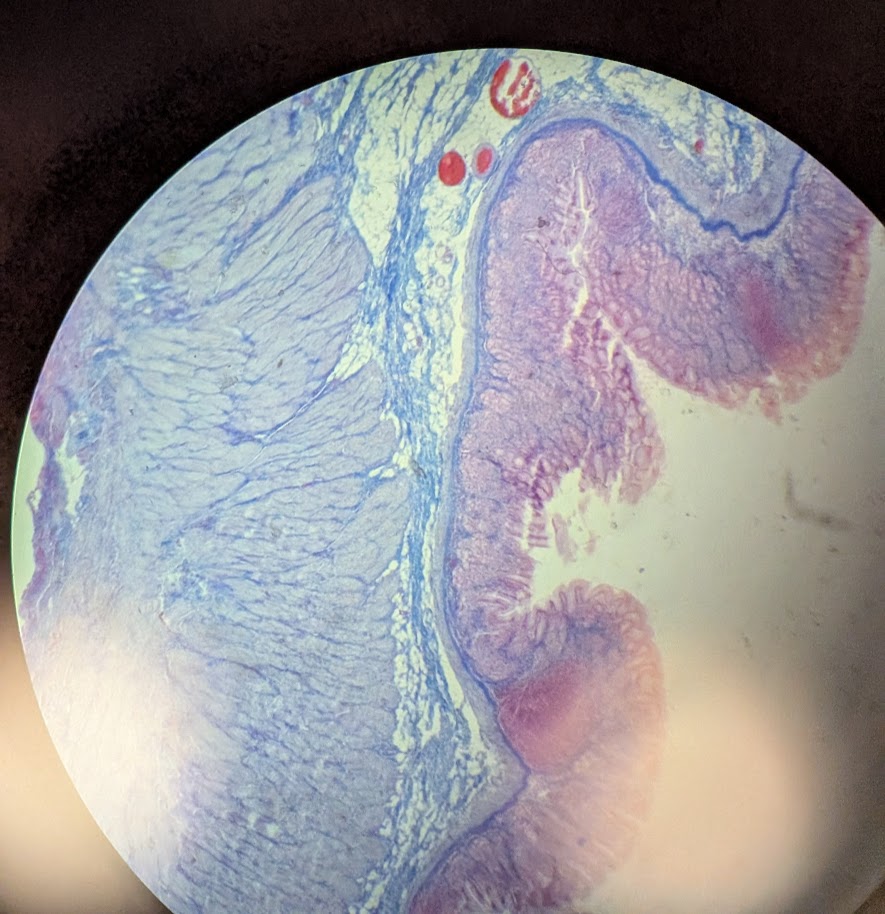 <p>Where in the body is this</p>