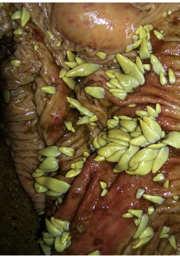 <p>Tapeworm in horses</p>