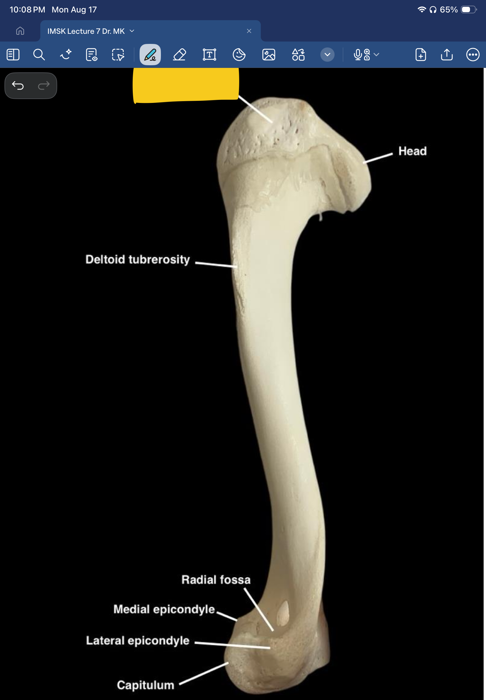 term image