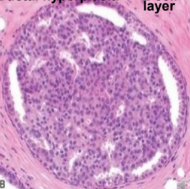 <p>What pathology? </p>