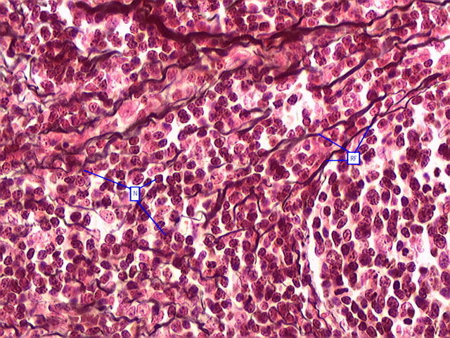 <p>what is this tissue?</p>