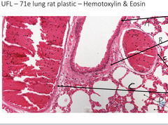 <p>What epithelium is indicated by the arrow labeled 'A' in this slide of rat lung?</p>
