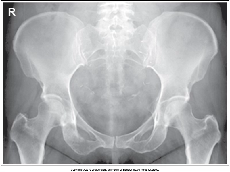 <p>AP pelvis</p>