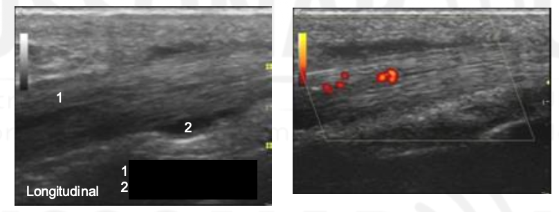 <p>Name 1 and 2.</p>