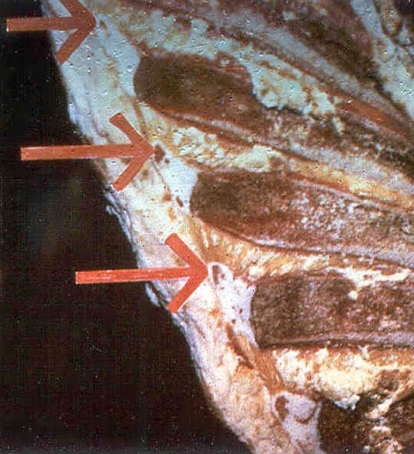<p>Defect seen in carcasses with C, D, and E maturity</p><ul><li><p>Also called “blue backs”</p></li><li><p>Caused by age—increase of ossification</p></li></ul><p></p>