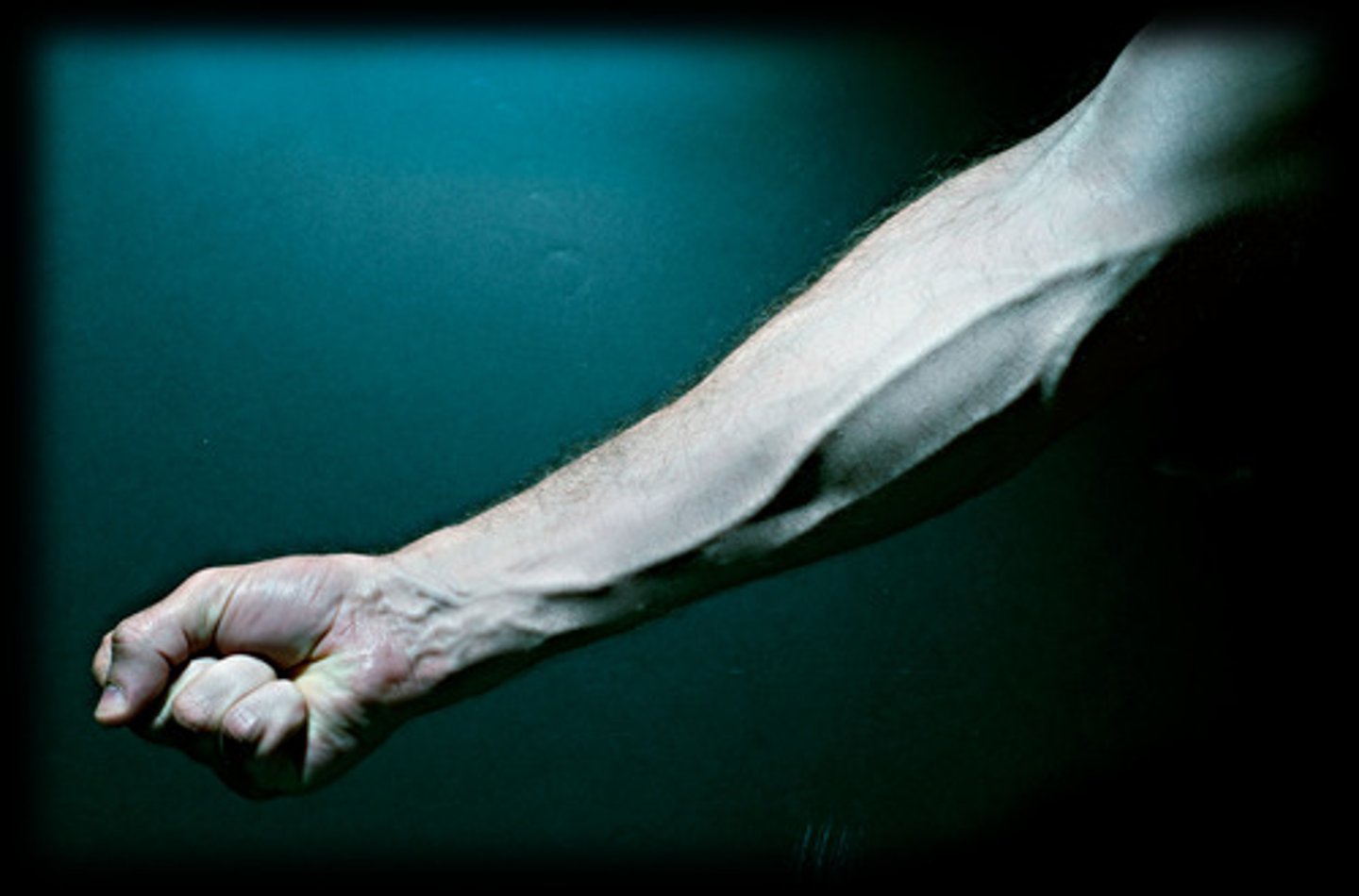 <p>Brazo</p>