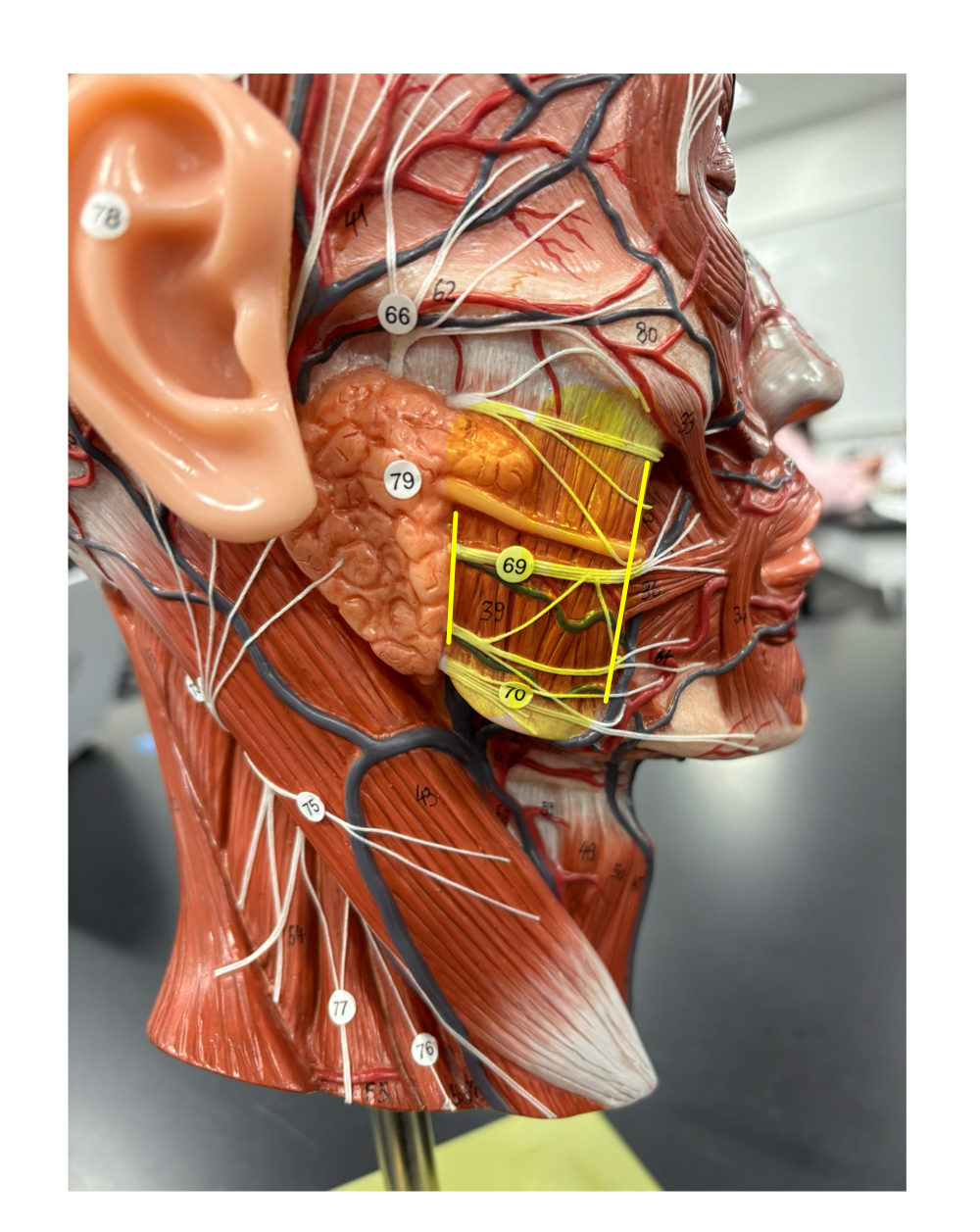 <p>name the muscle and its antagonist</p>