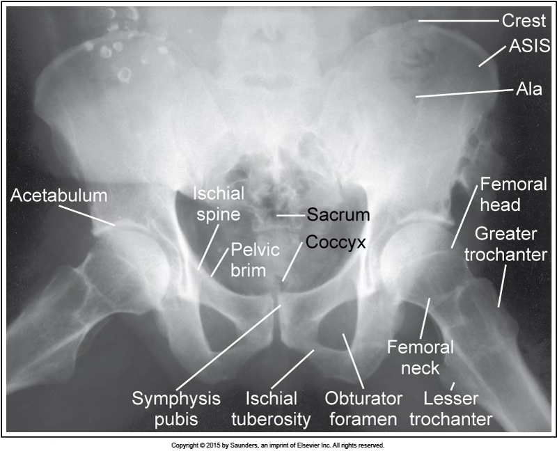 <p>AP frog leg/pelvis</p>