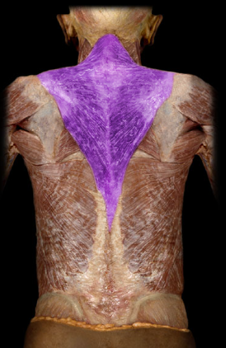 <p>bilateral neck extension, unilateral scapular rotation, retraction, and elevation</p>