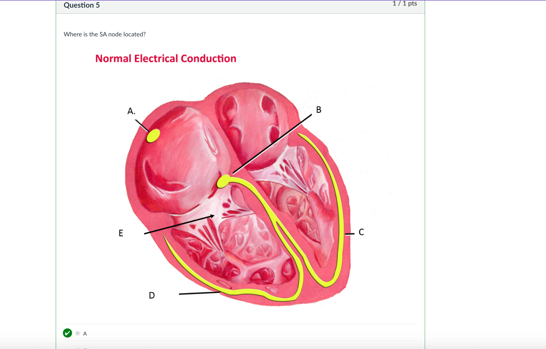 <p>Where is the SA node located?</p>