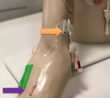<p>Name the&nbsp;<span><strong>purple arrow</strong></span>.</p>