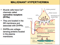 <p>A genetic hypermetabolic response of skeletal muscles primarily to halogenated ethers and succinylcholine.</p>
