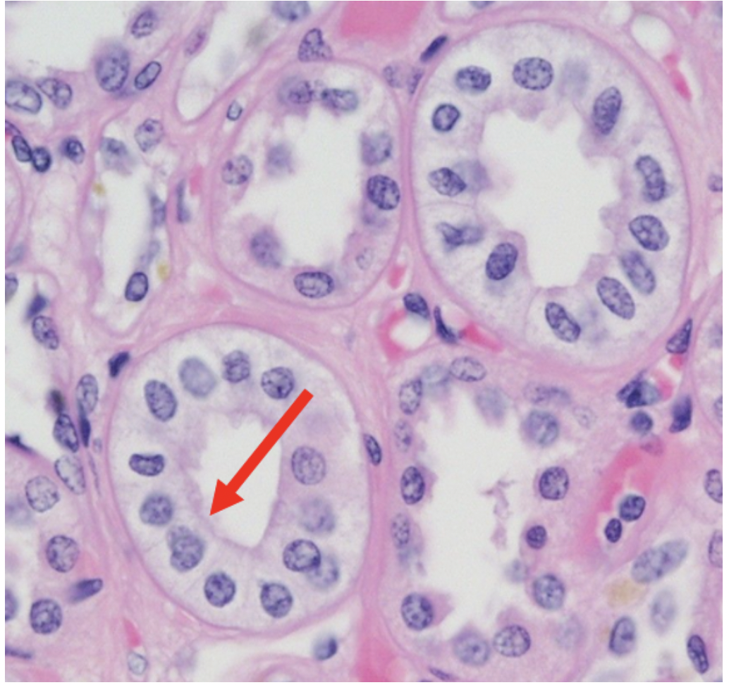 <p>Identify the tissue type at the tip of the red arrow</p>