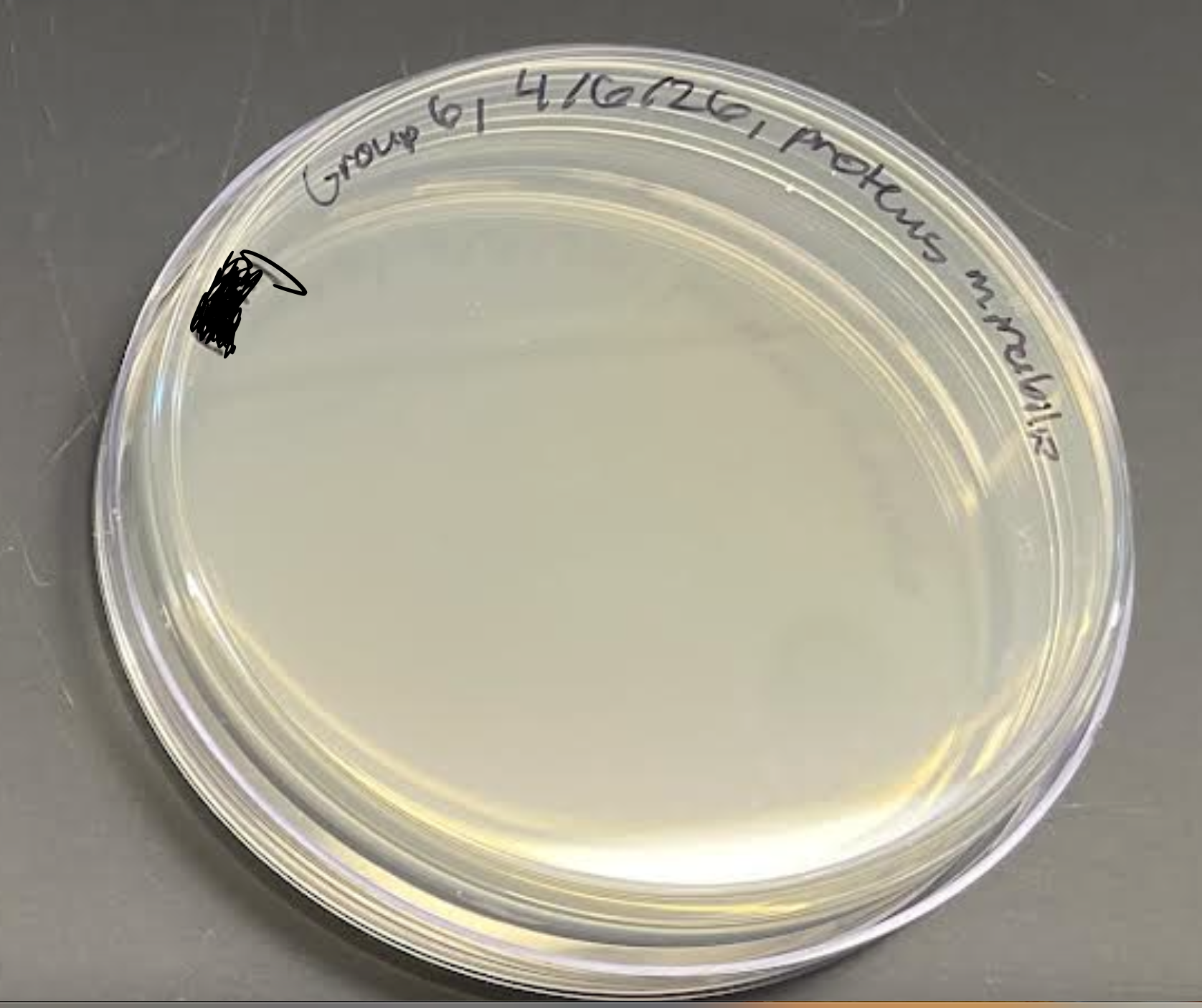<p>What is this plate’s name, selective agent, results and everything about it?</p>