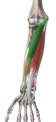 <p>Common flexor tendon at medial epicondyle of humerus</p>