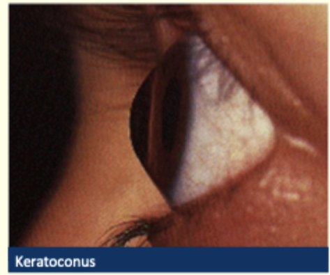 <p>Describe and give diagnosis</p>