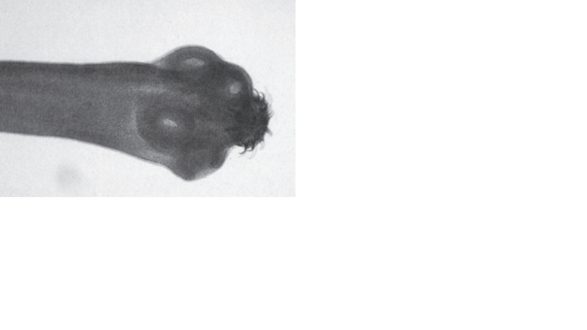 <p>Name the fluke or flatworm</p>