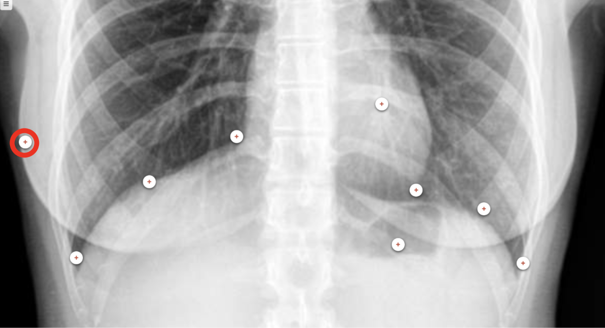 <p>what structure is the red circle labeling?</p>