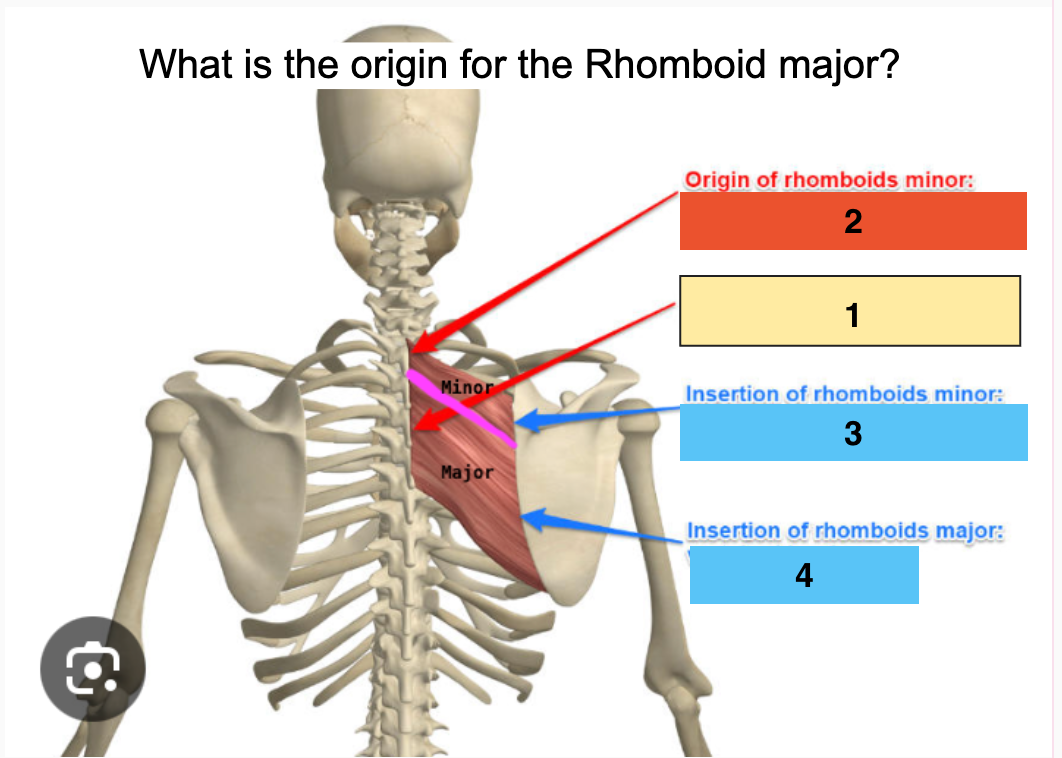 <p>What is the Rhomboid major (1) <span style="color: rgb(214, 51, 51);"><strong>Origin</strong></span>?</p>