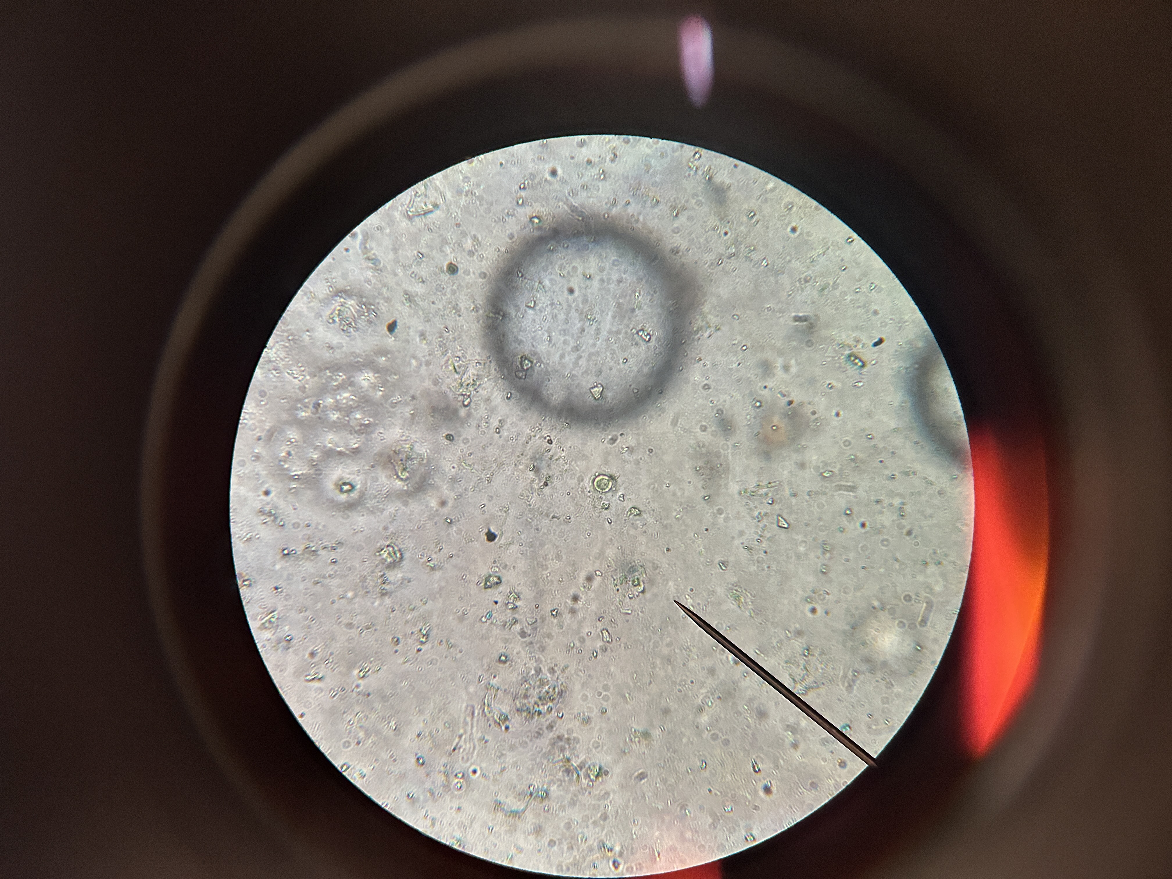 <p>What happens to animal cells in a hypotonic solution.</p>