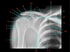 <p>What is labeled 17?</p>