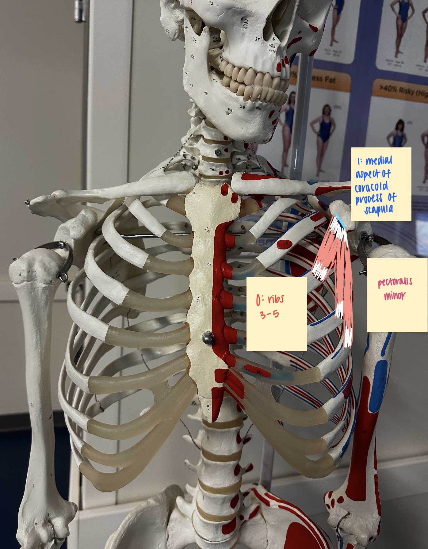 <ul><li><p>O: 3rd, 4th, &amp; 5th ribs</p></li><li><p>I: medial surface of coracoid process of the scapula</p></li><li><p>A: scapular protraction + shoulder ABDuction</p></li><li><p>N: medial pectoral nerve</p></li></ul><p></p>