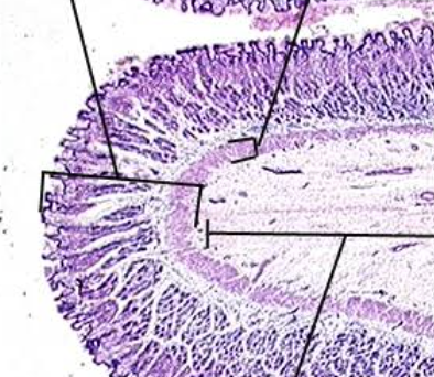 <p>Identify the mucosa </p>