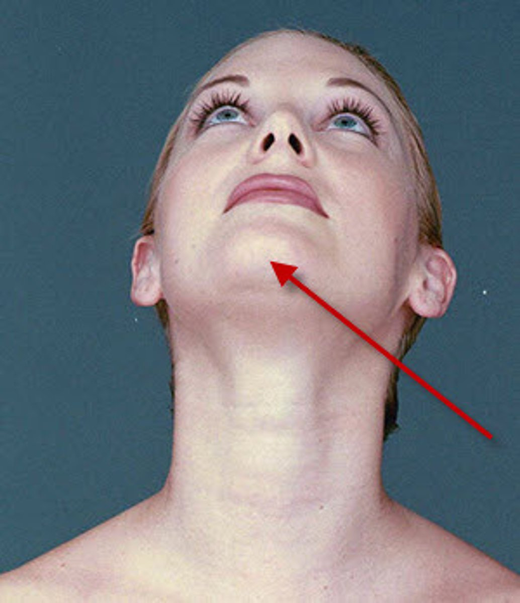 <p>Define the following:</p><p>The <strong>most inferior </strong>point of contour of the <strong>chin</strong></p>