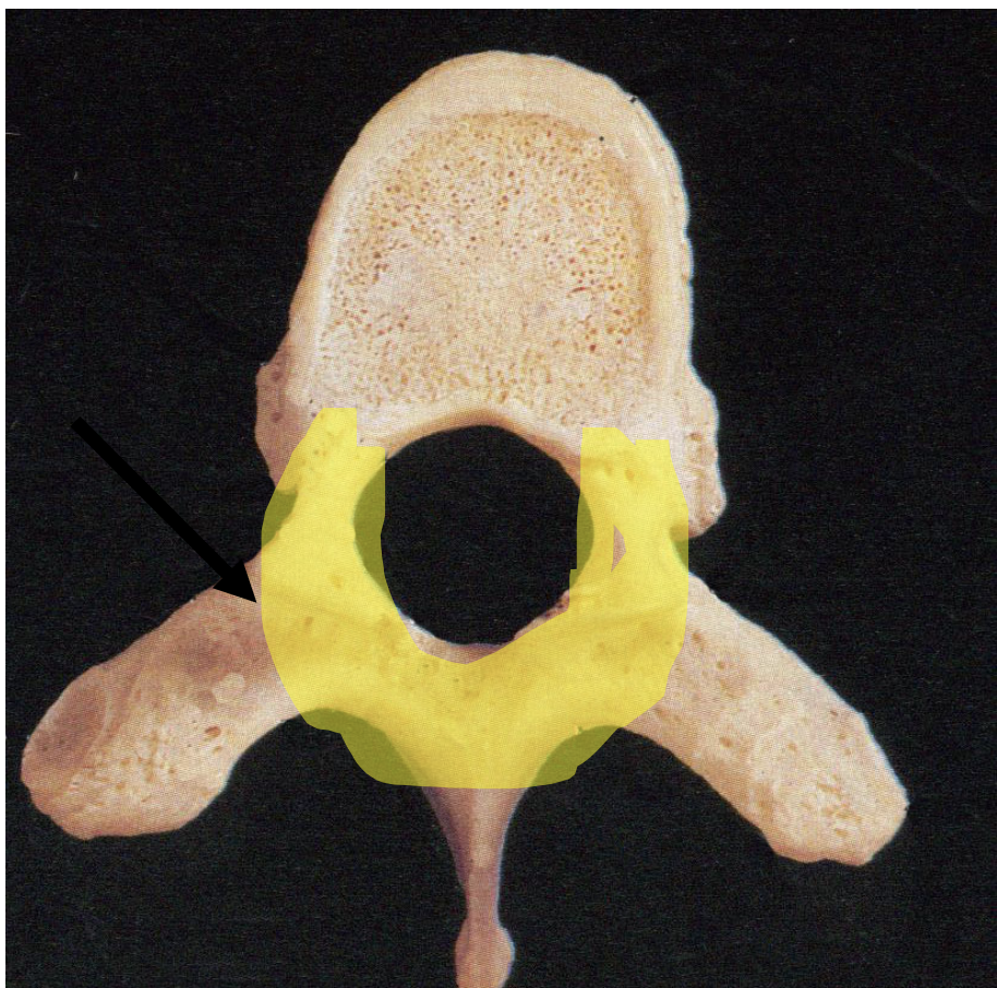 <p>General feature of all three types of Vertebrae</p>