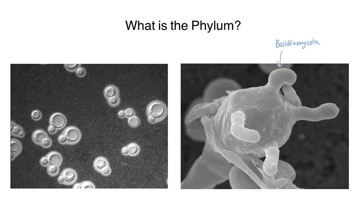 <p>The fungus belongs to Basidiomycota.</p>