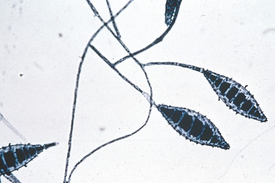 <p>Name</p>