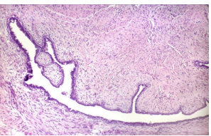<p>What pathology?</p>