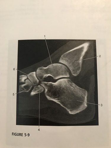 <p>Which of the following best describes the type of image displayed in the figure?</p><p>S) sagittal maximum intensity project (MIP)</p><p>B) direct sagittal acquisition </p><p>C) sagittal multiplanar reformation (MPR)</p><p>D) volume- rendered (3D) </p>