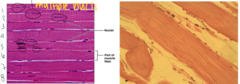 <p>What type of muscle tissue is this?</p>