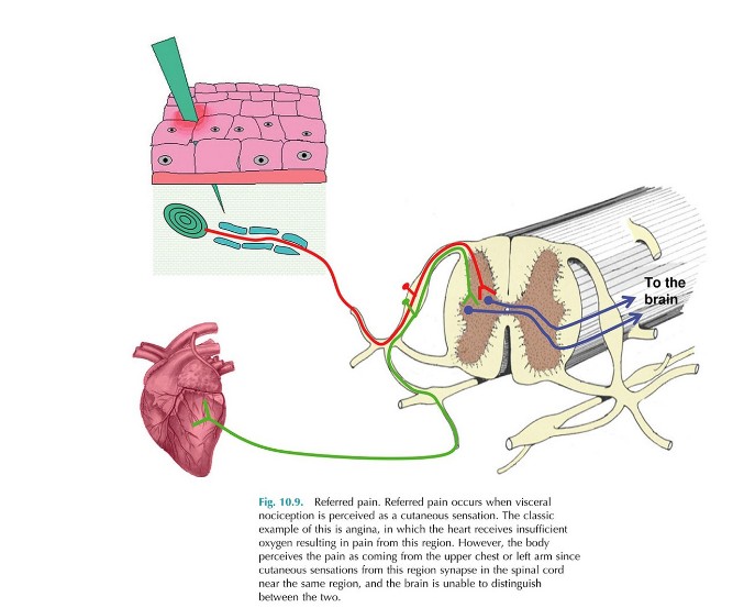 <p>Referred pain occurs because most ….. sensations are not well …..</p>