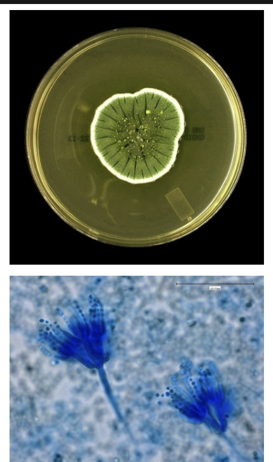 <p>-Usually a contaminant, but can cause infection</p><p>-Blue-green powdery colonies with white border</p><p>-”Skeleton hand” phialide and conidia arrangements</p>