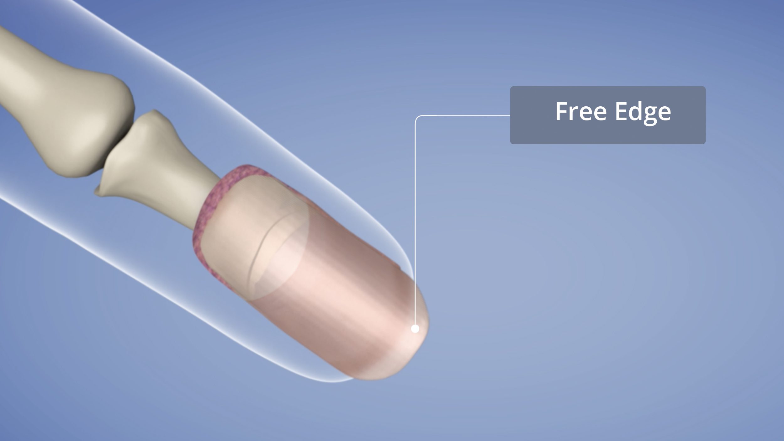 <p>Free edge</p>