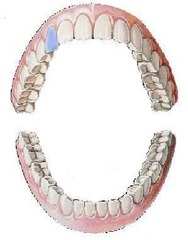 <p>maxillary right canine</p>