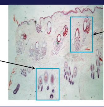<p>What phases of growth are these hairs in?</p>
