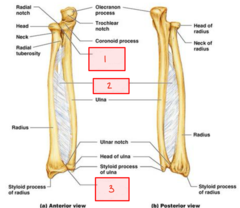 <p>What is labeled 1?</p>