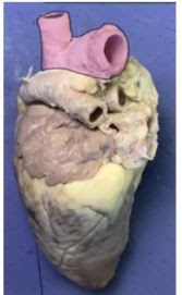 <p><span>Which vessel is this?&nbsp; It delivers oxygen rich blood to the systemic body cells.</span></p>