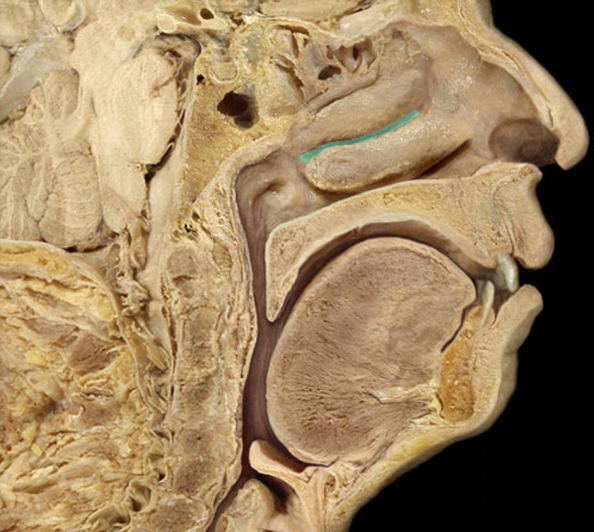<p>Identify the feature of the nasal cavity</p>
