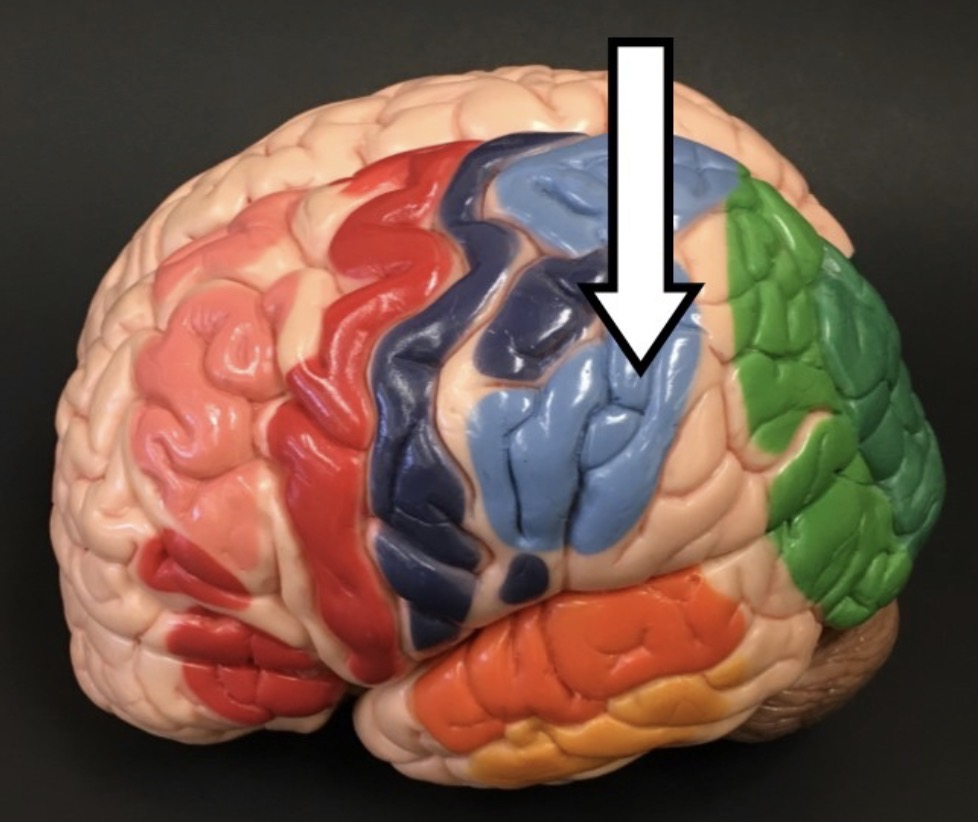 <p>What lobe is the arrow pointing to?</p>