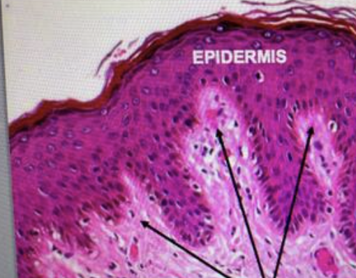 <p>the parts of the dermis that extend into the epidermis between each rete ridge of the epidermis </p>
