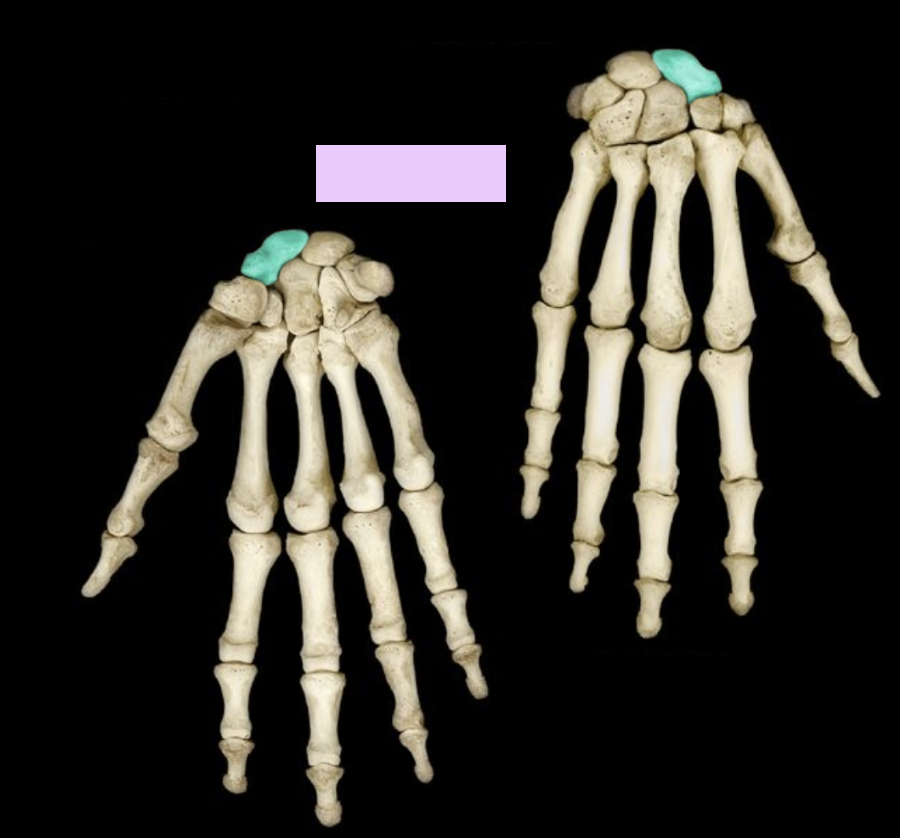 <p>What structure is highlighted?</p>