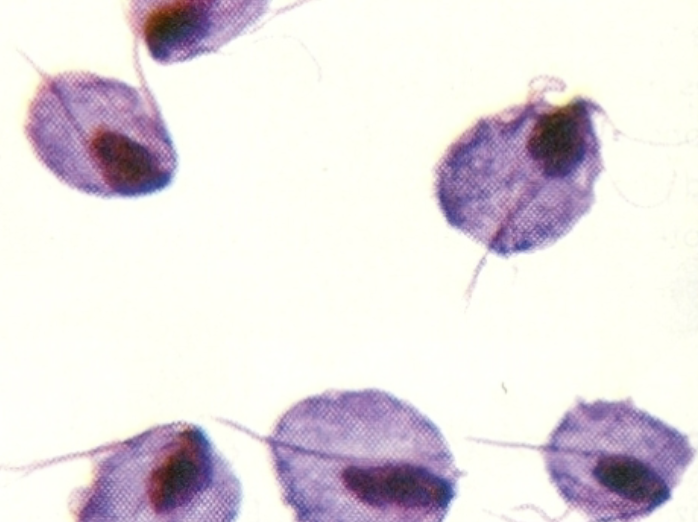 <p>What protist is this?</p>