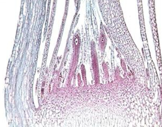 <p>female</p>