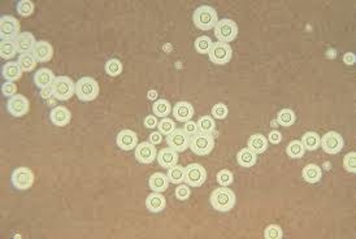 <p>No pseudohyphae</p><p>Round cells with small isthmus</p><p>Capsule</p>